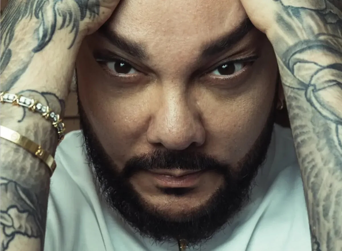Kirkorov əməliyyatdan sonra…