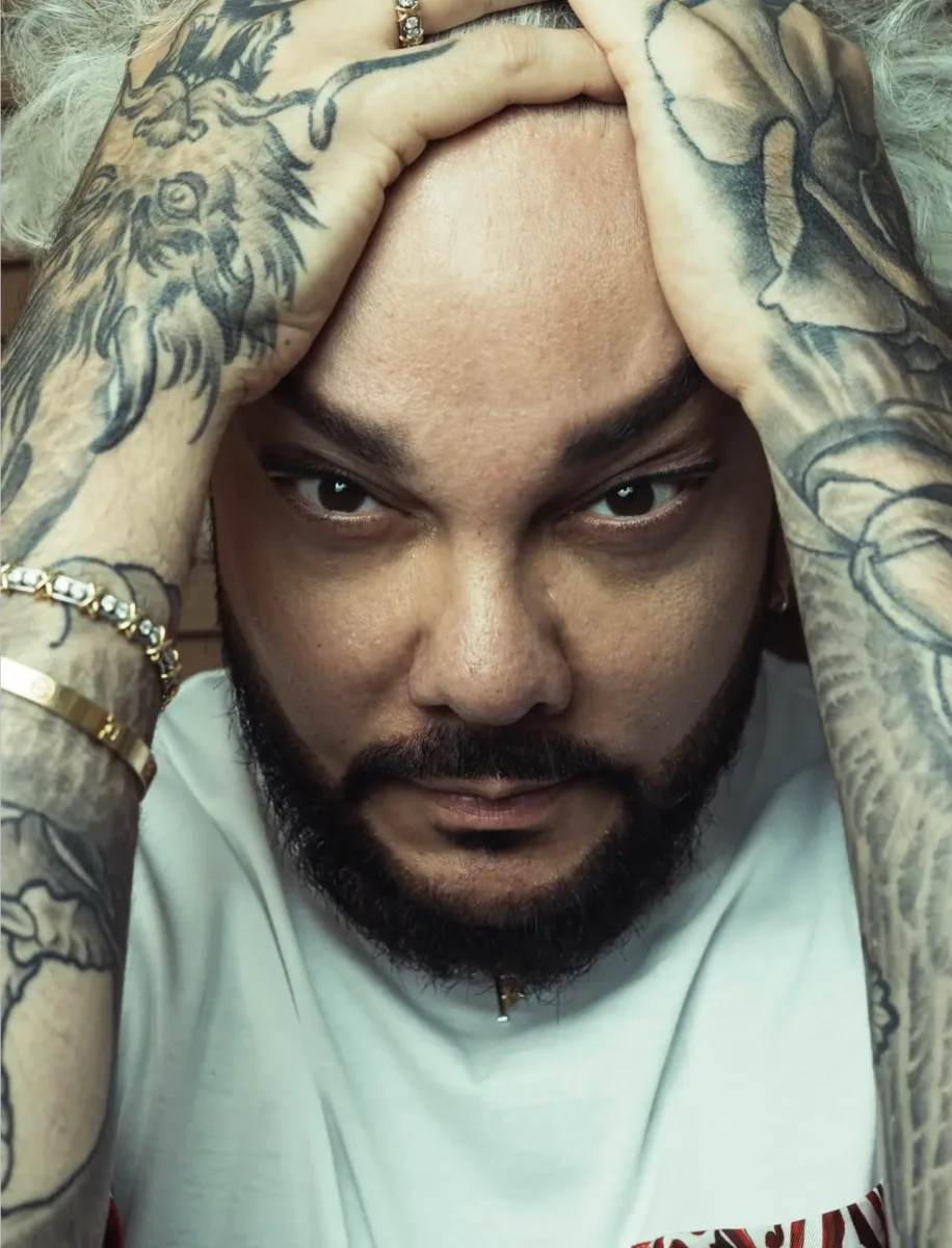 Kirkorov əməliyyatdan sonra…
