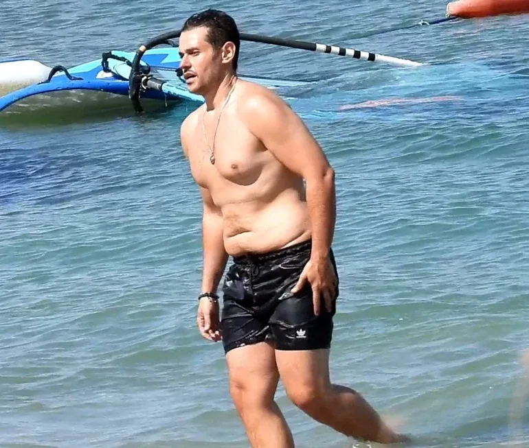 “O fotodan sonra ac gəzirəm”