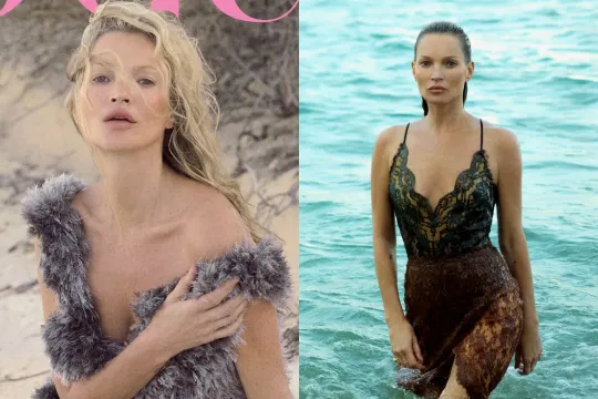 Bu dəfə “Vogue” üçün soyundu