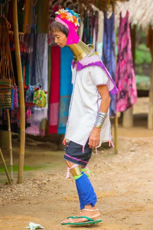 “Halqaları çıxarsalar, boyunları sına bilər” - Bu dəfə Taylandda