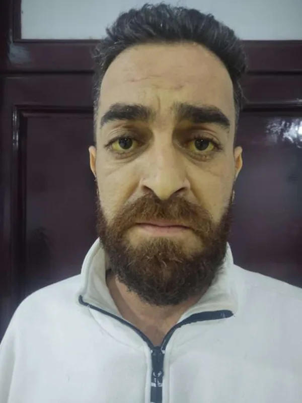 Aktyorun vəziyyəti ağırdır - 90 min lazımdır