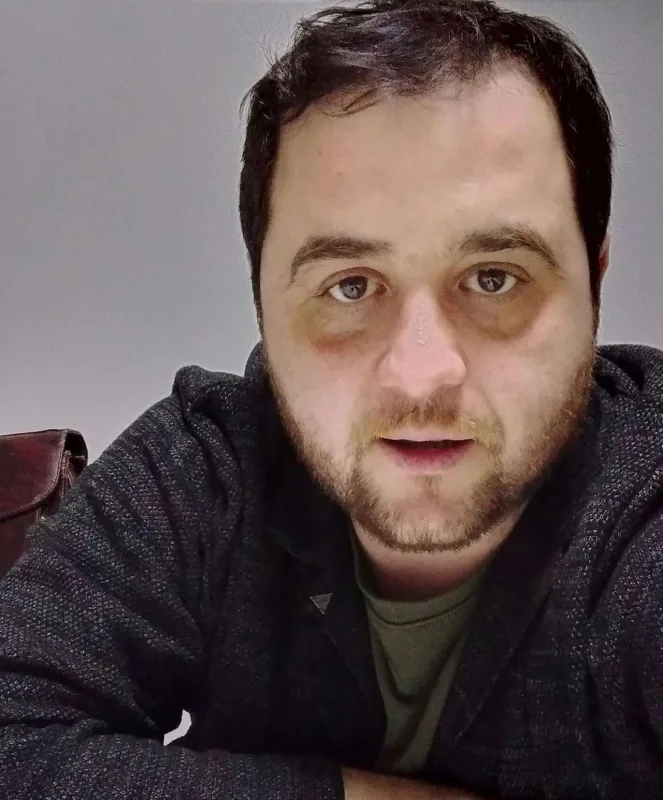 Nazirlikdən rejissorun tənqidlərinə reaksiya