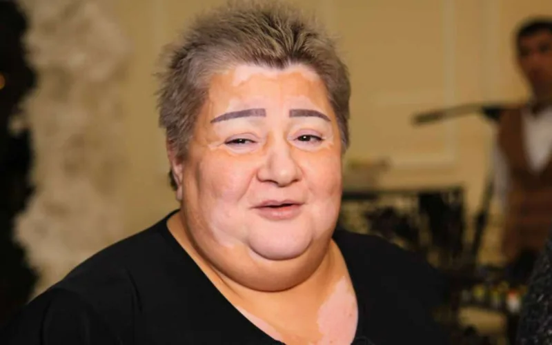 “İnsan bir gündə neçə dəfə ölüb-dirilər?!”