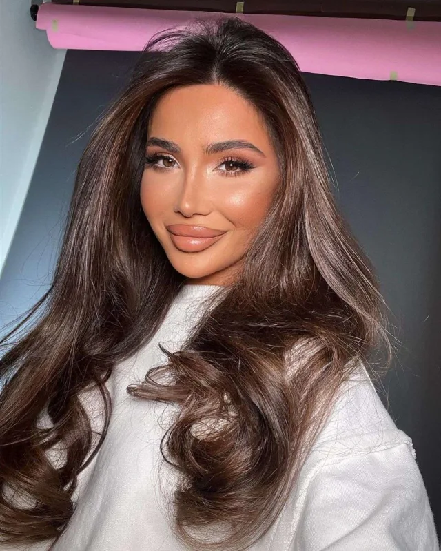 İtlər məşhur influenserə hücum etdi