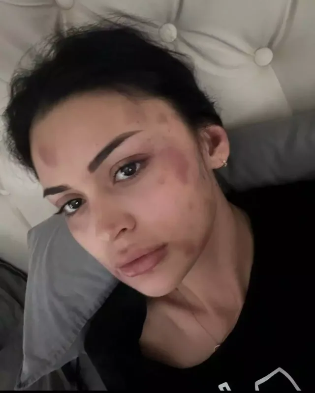 “Ondan olan uşağı abort etdirdim”