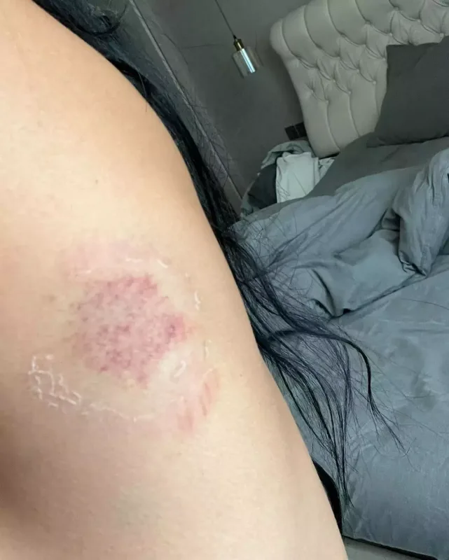 “Ondan olan uşağı abort etdirdim”