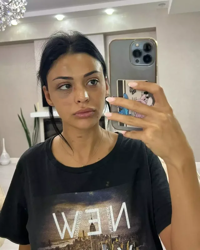 “Ondan olan uşağı abort etdirdim”