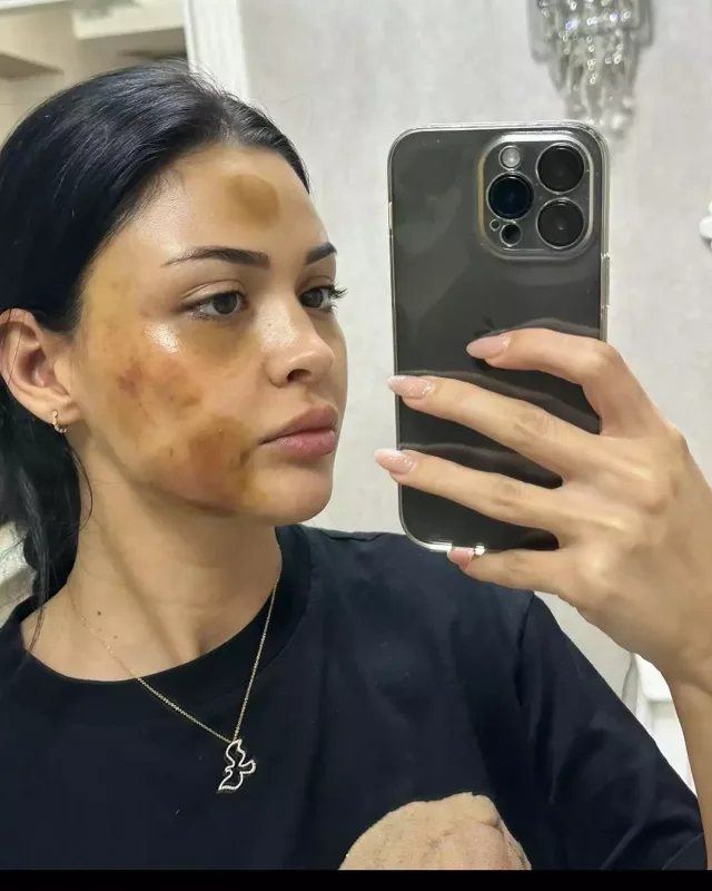 “Ondan olan uşağı abort etdirdim”