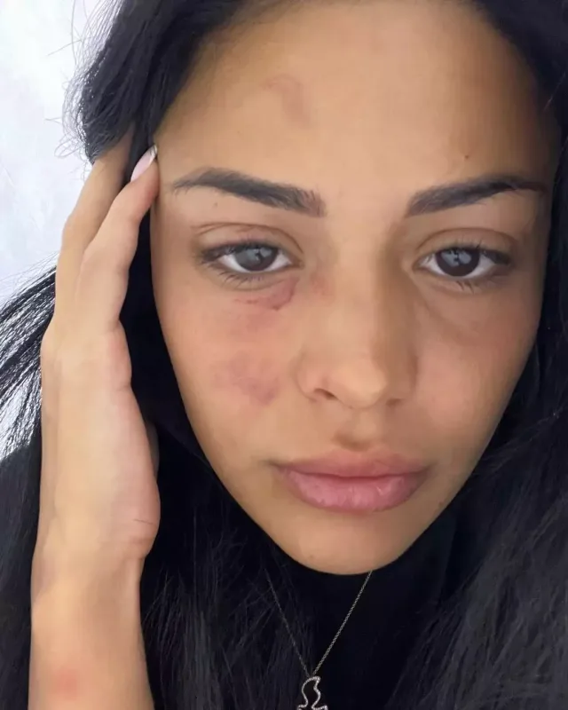 Ziya barəsində 4 aylıq həbs qətimkan tədbiri!