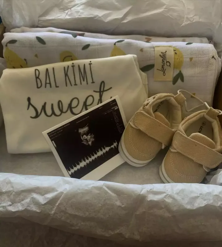 Tamaşadan getmə səbəbi bilindi