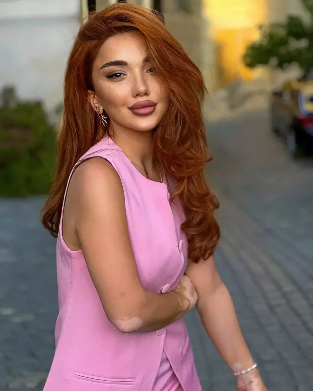 Azərbaycanlı blogerdə xərçəng aşkarlandı