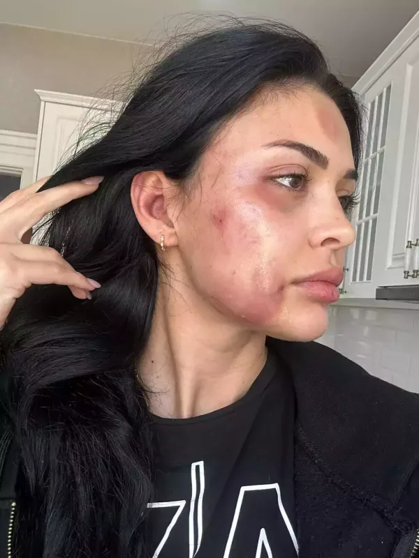 Razinin əllərini bağlayaraq xəsarət yetirib - Məhkəmədən!