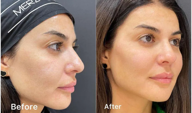 Sevincin estetiklə dəyişimi