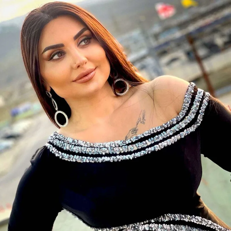 Şəbnəm də estetik əməliyyat etdirir