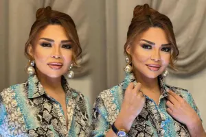 Günü-gündən arıqlayır