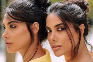 “Botoks etdirdim, 4 gün keçmədi, əritdirdim”