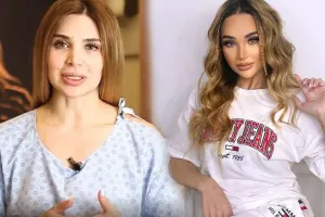 Ülviyyə Bellaya oxşamaq üçün estetik etdirdi