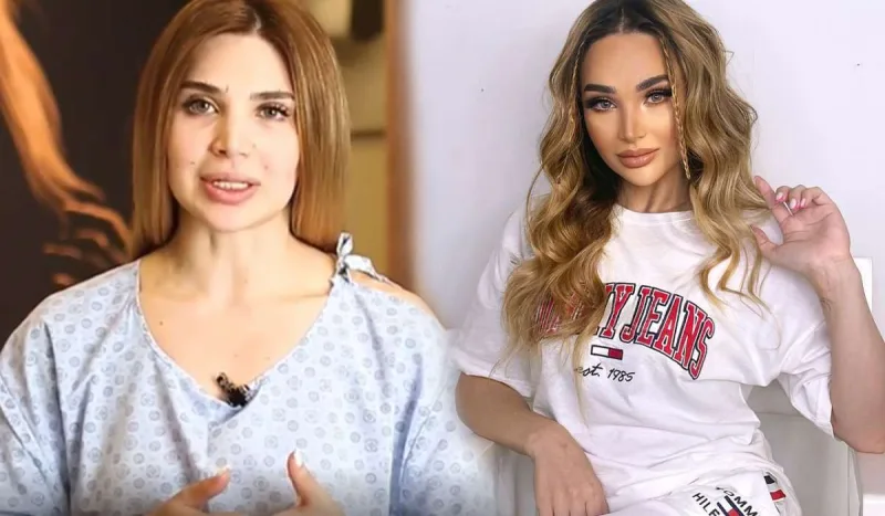 Ülviyyə Bellaya oxşamaq üçün estetik etdirdi