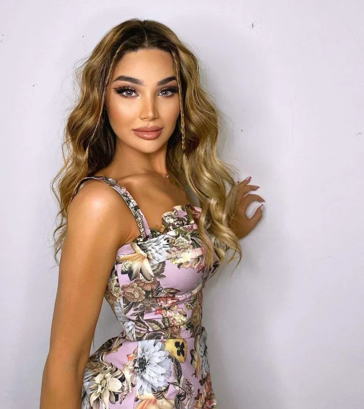 Ülviyyə Bellaya oxşamaq üçün estetik etdirdi