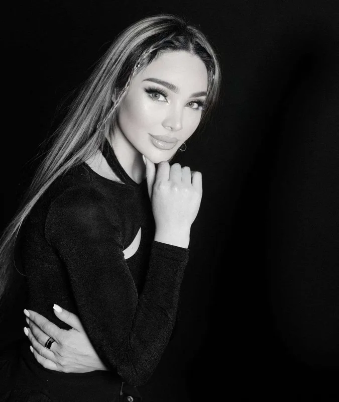 Ülviyyə Bellaya oxşamaq üçün estetik etdirdi