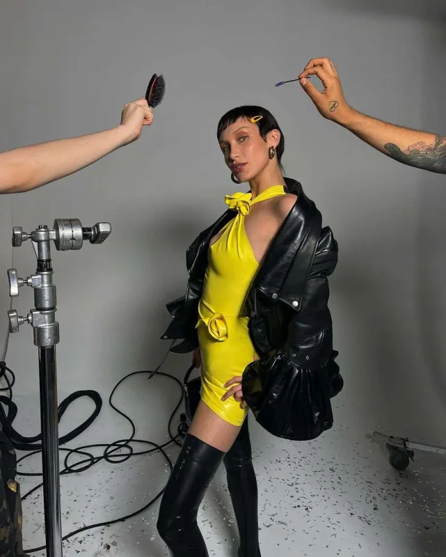 Ülviyyə Bellaya oxşamaq üçün estetik etdirdi