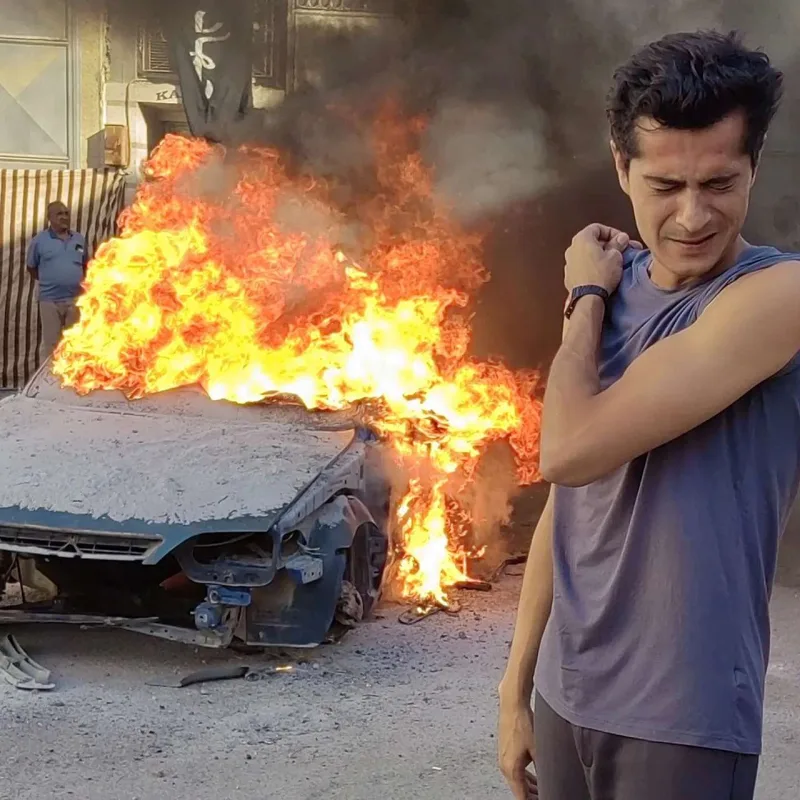 Çəkiliş zamanı ölümdən döndü