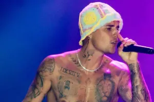 Üzü iflic olan Castin yenidən səhnədə