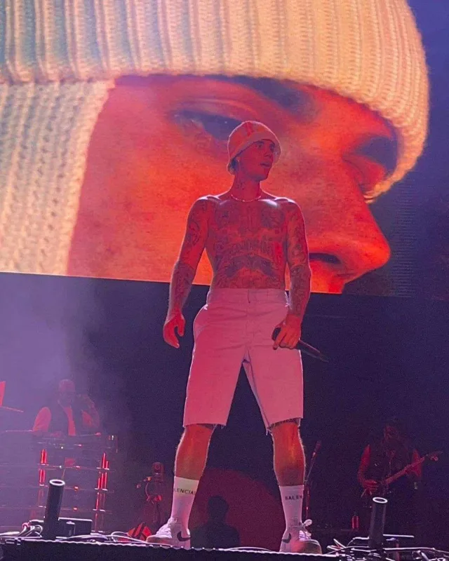 Üzü iflic olan Castin yenidən səhnədə