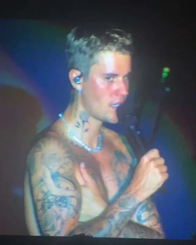 Üzü iflic olan Castin yenidən səhnədə