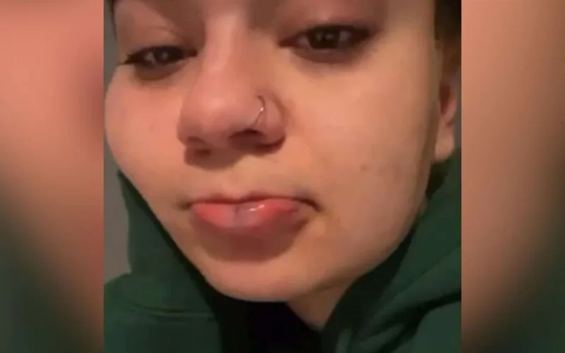 Azərbaycanlı repçi qızını döydü - Foto