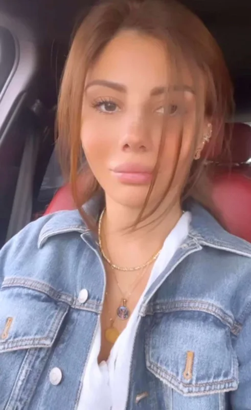 Aysel estetik sonrası görüntüsünü paylaşdı