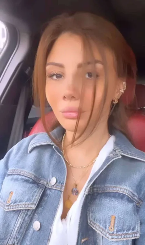 Aysel estetik sonrası görüntüsünü paylaşdı