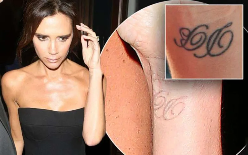 Viktoriya Devidin baş hərfi olan döyməni niyə sildirib?