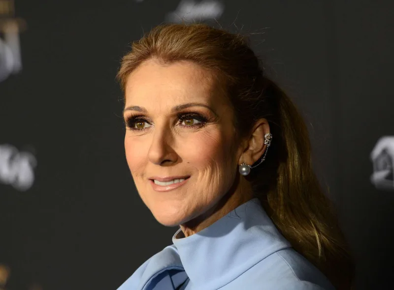 “Kirkorov məni görüb, deyib ki, bu, Selin Diondur?”