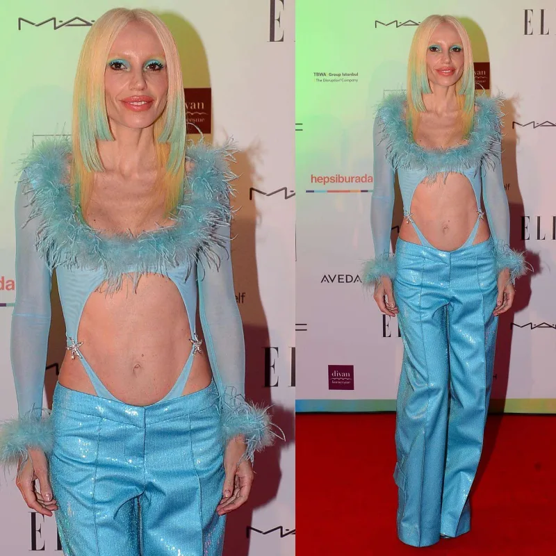 Mükafatı LGBTQ+ üzvləri üçün aldı