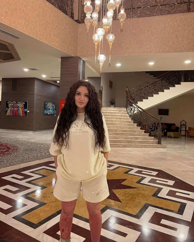 “Dedilər, get hara istəyirsən, şikayət elə!” - Yanğın qalmaqalı