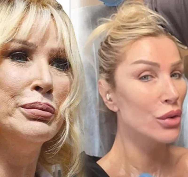 Sedanın bitməyən estetikləri