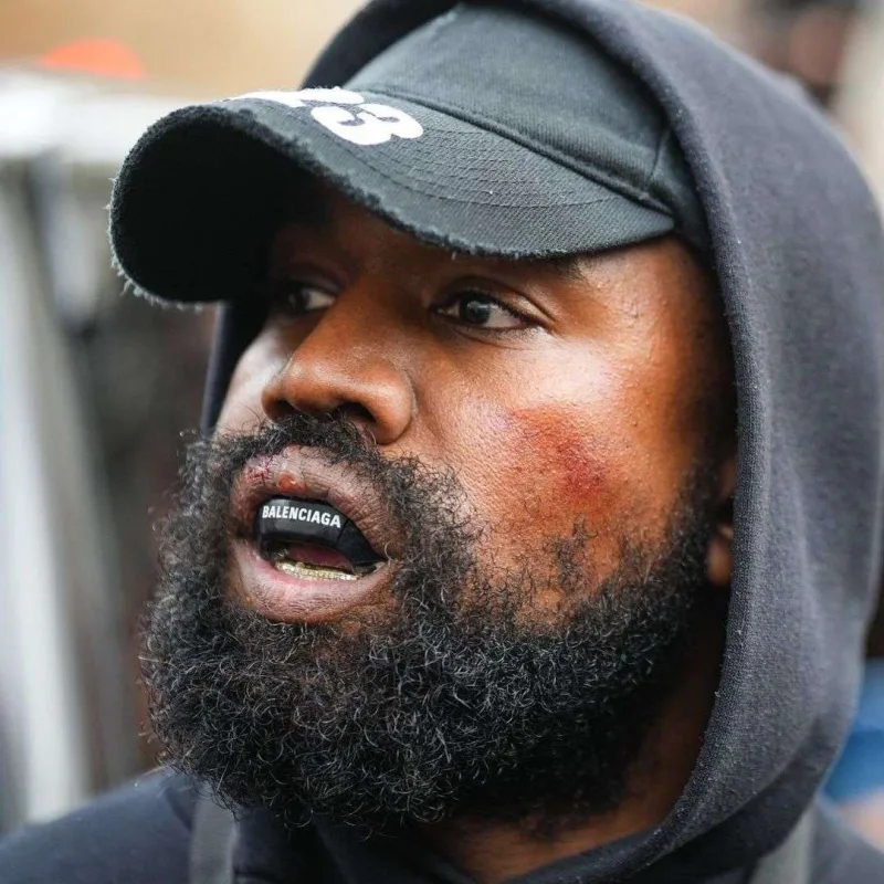 Məşhur brend paylaşımlarına görə Kanyeni “sildi”