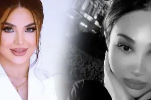 Ülviyyənin üzündəki dəyişiklik diqqət çəkdi