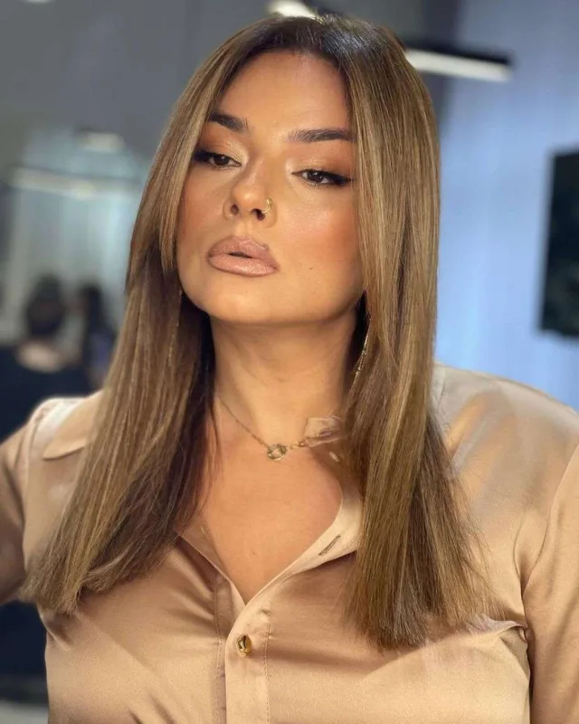 İtlərin hücum etdiyi Kamilədən açıqlama