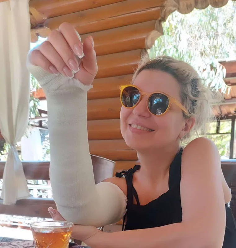 Əli çəkilişdə sınıbmış