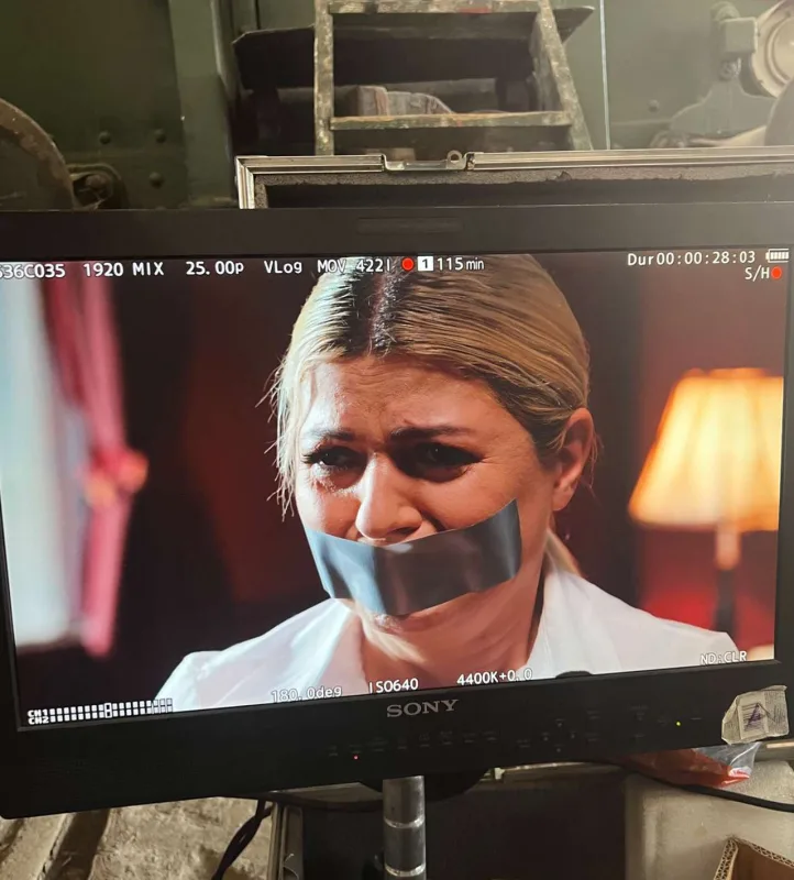 Əli çəkilişdə sınıbmış