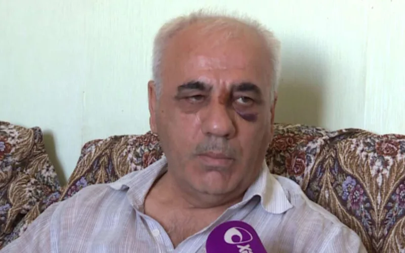 Xalq artistinin qardaşı beşbarmaqla döyülüb