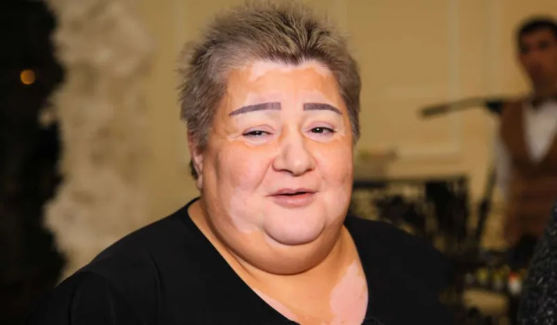 Könül Xasıyevanın səhhəti pisləşdi