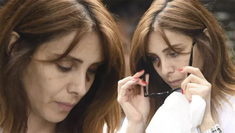 Gözündəki yaranı gizlətməyə çalışdı