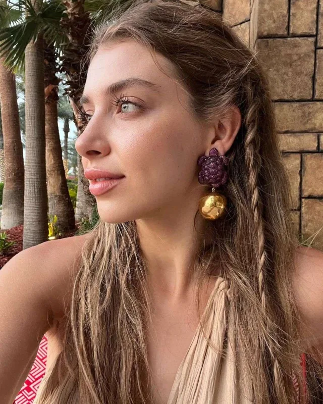 Botoks etdirdiyi üçün peşman oldu