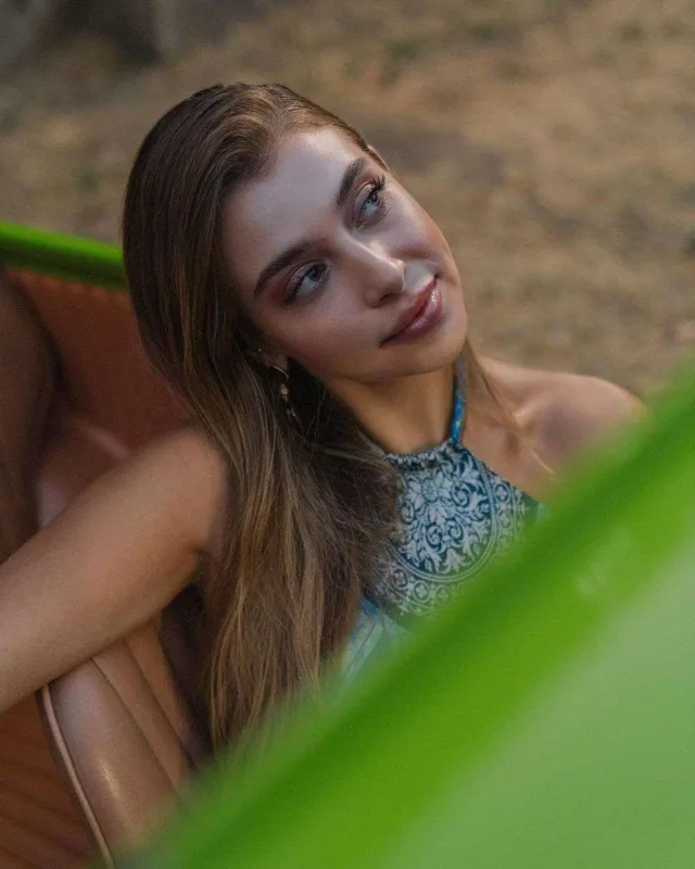 Botoks etdirdiyi üçün peşman oldu