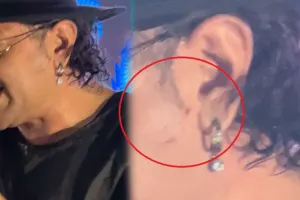 Rəhimin üzünə nə olub? - VİDEO