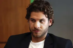 Dava səhnəsində burnu sındı